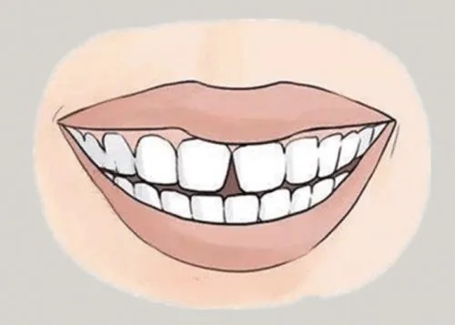 <a href=http://m.indolingual.com/news_article?news_id=116>一次性口腔探针</a>